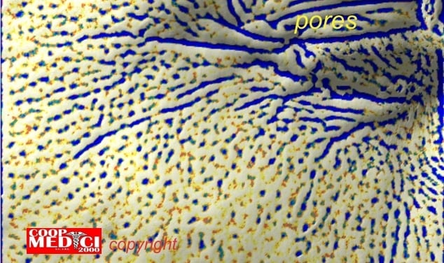 Number and density of pores