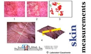 Immagine al microscopio della misura delle macchie di iperpigmentazione e delle rughe della pelle nei Laboratori Casalvento