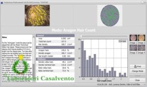 Schermata del responso TrichoScan HD in alto capelli in colore giallo e verde, in basso i risultati numerici rappresentati con grafico a barre