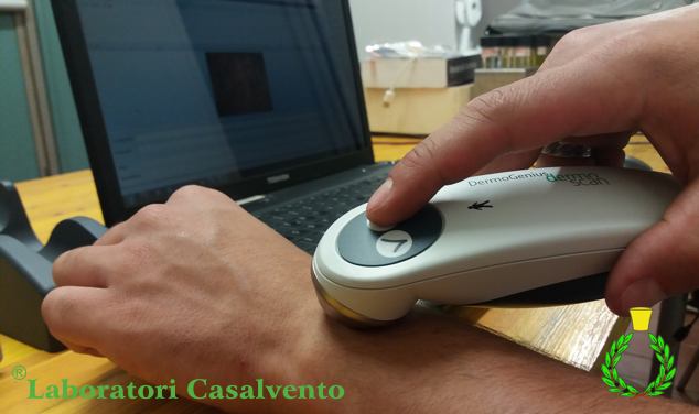 TrichoScan HD measuring instrument applied to the wrist with a laptop in the background and the wording Laboratori Casalvento